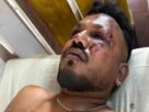 இந்திய விமான விபத்தில் தப்பியவருக்கு நேர்ந்த கதி